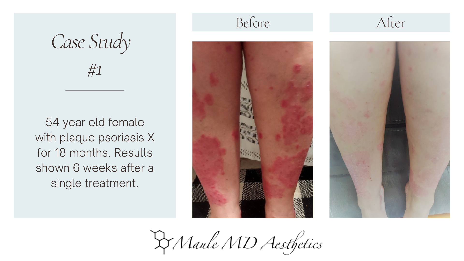 Regenerative Skin Treatment