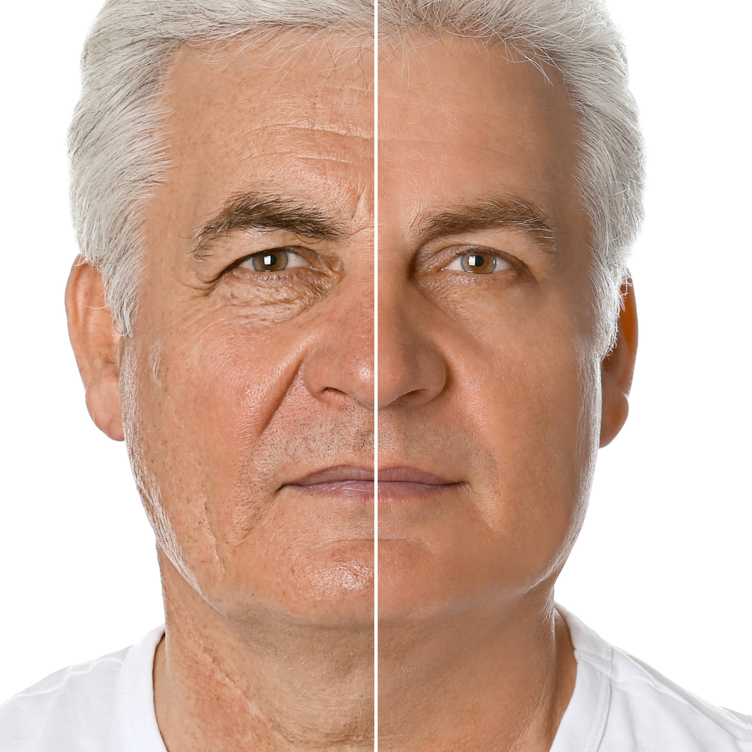 Mature man before and after plastic surgery on white background
